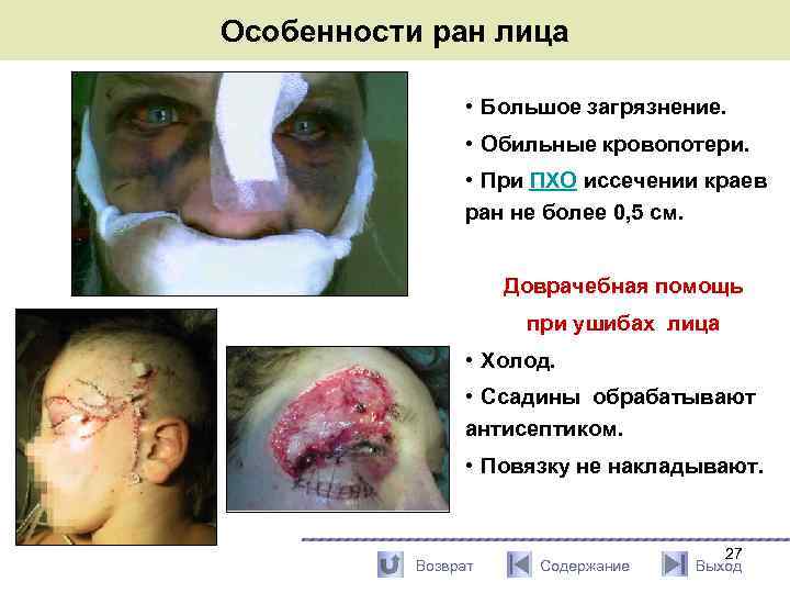 Особенности ран лица • Большое загрязнение. • Обильные кровопотери. • При ПХО иссечении краев