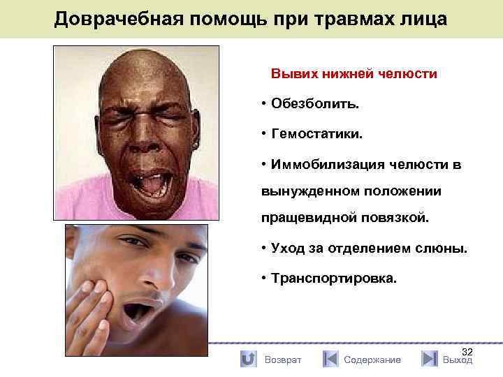 Доврачебная помощь при травмах лица Вывих нижней челюсти • Обезболить. • Гемостатики. • Иммобилизация