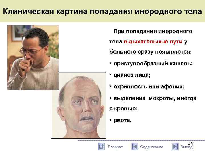 Клиническая картина попадания инородного тела При попадании инородного тела в дыхательные пути у больного