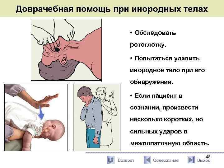 Инородное тело гортани карта вызова смп