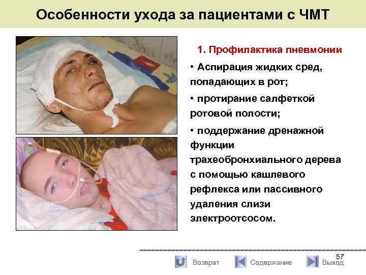 Особенности ухода за пациентами с ЧМТ 1. Профилактика пневмонии • Аспирация жидких сред, попадающих