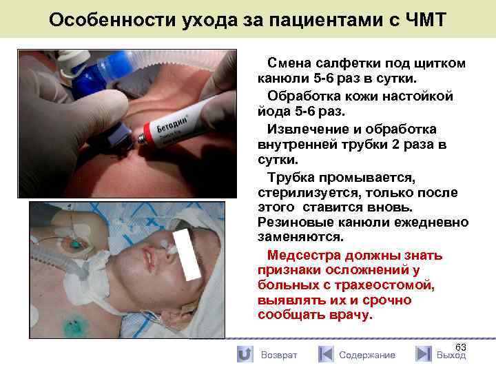 Особенности ухода за пациентами с ЧМТ Смена салфетки под щитком канюли 5 -6 раз