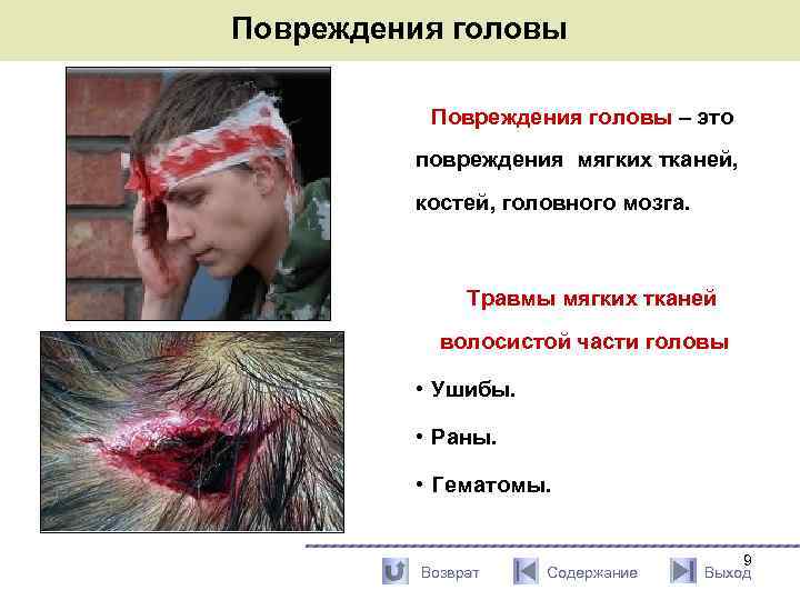 Повреждения головы – это повреждения мягких тканей, костей, головного мозга. Травмы мягких тканей волосистой