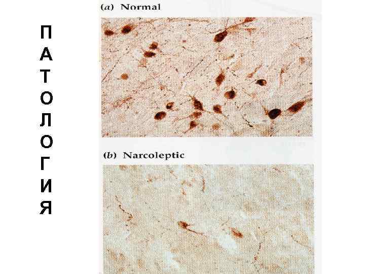 П А Т О Л О Г И Я 