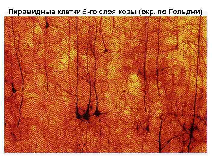 Пирамидные клетки 5 -го слоя коры (окр. по Гольджи) 