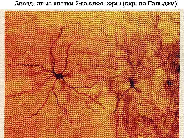 Звездчатые клетки 2 -го слоя коры (окр. по Гольджи) 