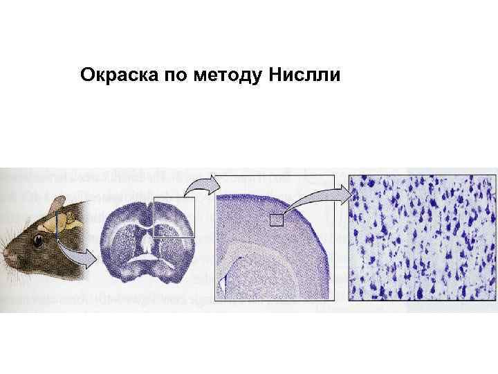 Окраска по методу Нислли 
