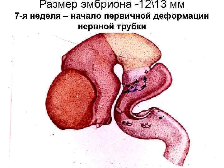 Размер эмбриона -1213 мм 7 -я неделя – начало первичной деформации нервной трубки 