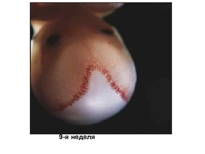 9 -я неделя 