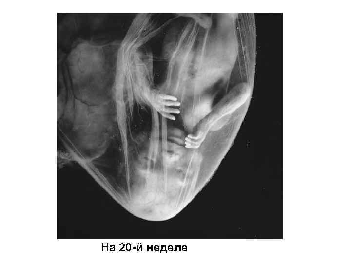 На 20 -й неделе 