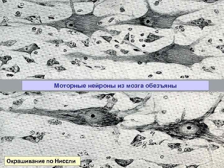 Моторные нейроны из мозга обезъяны Окрашивание по Ниссли 