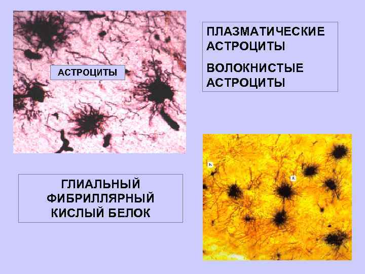 ПЛАЗМАТИЧЕСКИЕ АСТРОЦИТЫ ГЛИАЛЬНЫЙ ФИБРИЛЛЯРНЫЙ КИСЛЫЙ БЕЛОК ВОЛОКНИСТЫЕ АСТРОЦИТЫ 