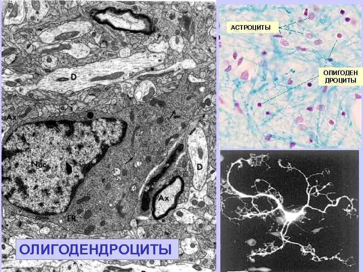 АСТРОЦИТЫ ОЛИГОДЕН ДРОЦИТЫ ОЛИГОДЕНДРОЦИТЫ 