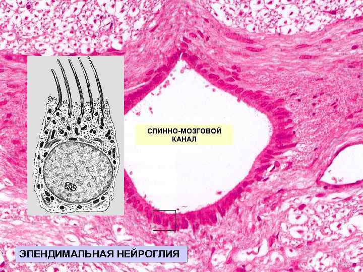 СПИННО-МОЗГОВОЙ КАНАЛ ЭПЕНДИМАЛЬНАЯ НЕЙРОГЛИЯ 