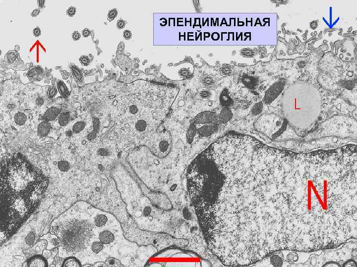 ЭПЕНДИМАЛЬНАЯ НЕЙРОГЛИЯ 