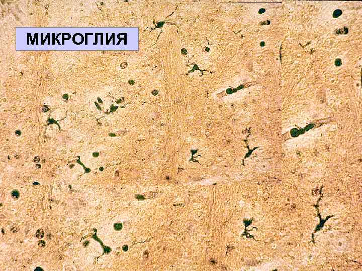 МИКРОГЛИЯ 