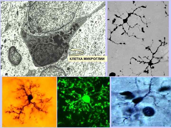 КЛЕТКА МИКРОГЛИИ 