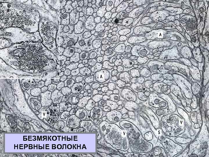 БЕЗМЯКОТНЫЕ НЕРВНЫЕ ВОЛОКНА 