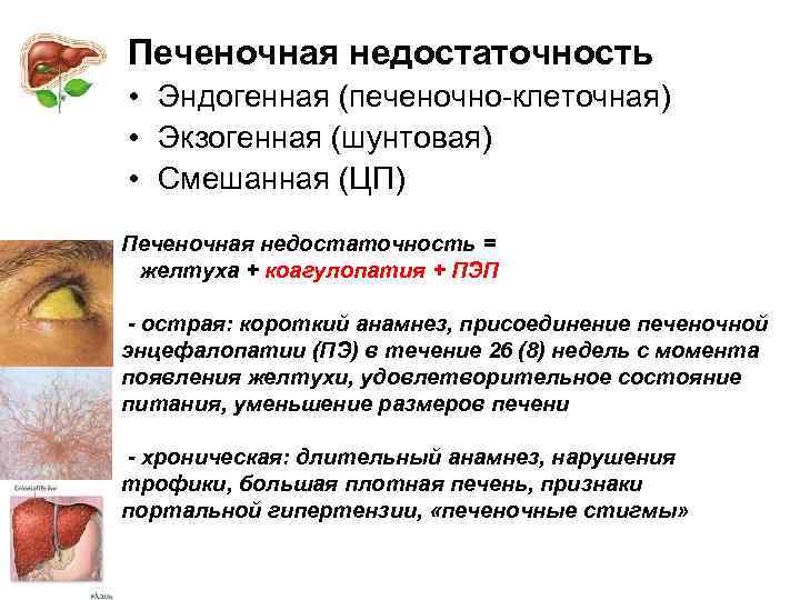 Печеночная недостаточность • Эндогенная (печеночно-клеточная) • Экзогенная (шунтовая) • Смешанная (ЦП) Печеночная недостаточность =