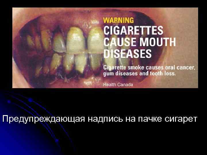 Предупреждающая надпись на пачке сигарет 