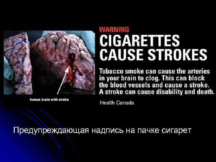 Предупреждающая надпись на пачке сигарет 