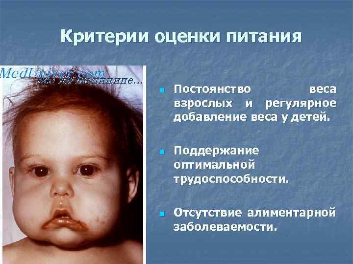 Критерии оценки питания n n n Постоянство веса взрослых и регулярное добавление веса у