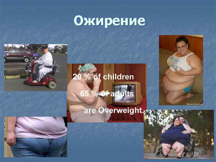 Ожирение 