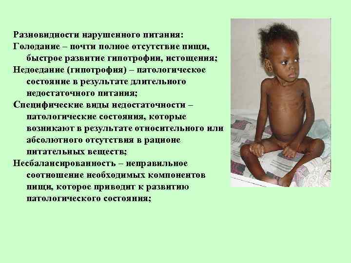 Разновидности нарушенного питания: Голодание – почти полное отсутствие пищи, быстрое развитие гипотрофии, истощения; Недоедание