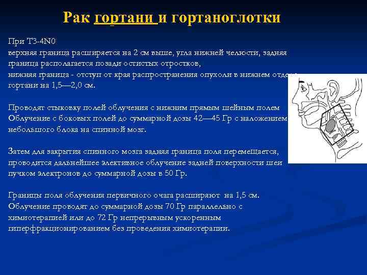 Рак гортани и гортаноглотки При T 3 -4 N 0 верхняя граница расширяется на