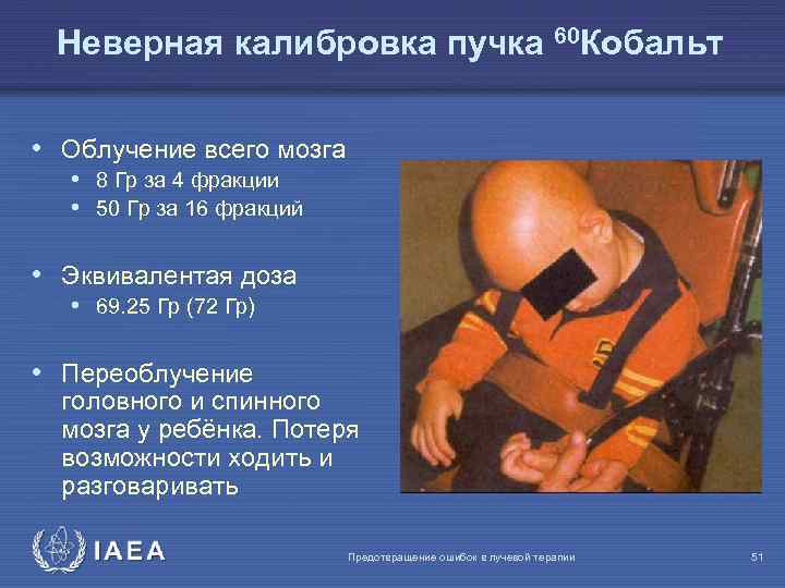 Неверная калибровка пучка 60 Кобальт • Облучение всего мозга • 8 Гр за 4