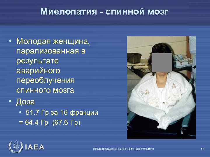 Миелопатия - спинной мозг • Молодая женщина, парализованная в результате аварийного переоблучения спинного мозга