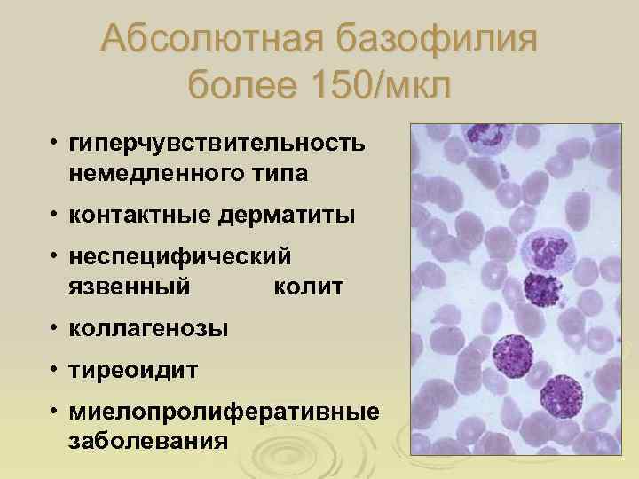 Абсолютная базофилия более 150/мкл • гиперчувствительность немедленного типа • контактные дерматиты • неспецифический язвенный