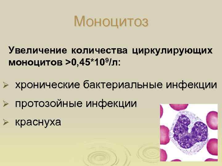 Моноцитоз Увеличение количества циркулирующих моноцитов >0, 45*109/л: Ø хронические бактериальные инфекции Ø протозойные инфекции