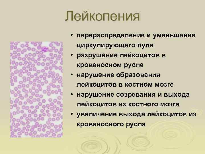 Лейкопения при анемии