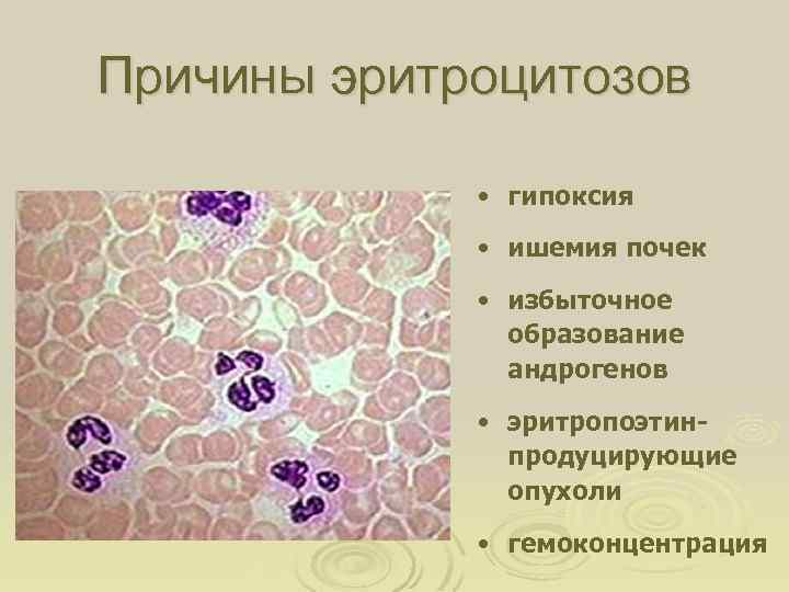 Причины эритроцитозов • гипоксия • ишемия почек • избыточное образование андрогенов • эритропоэтинпродуцирующие опухоли