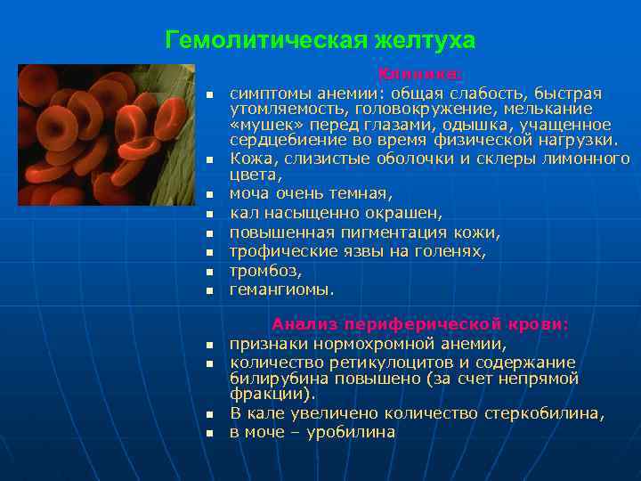 Гемолитическая желтуха n n n Клиника: симптомы анемии: общая слабость, быстрая утомляемость, головокружение, мелькание