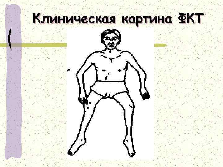 Клиническая картина ФКТ 