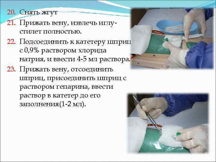 20. Снять жгут 21. Прижать вену, извлечь иглустилет полностью. 22. Подсоединить к катетеру шприц