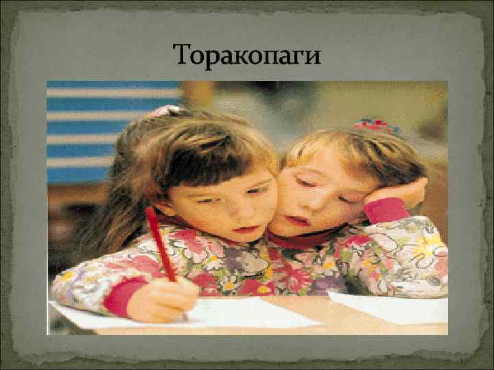 Торакопаги 