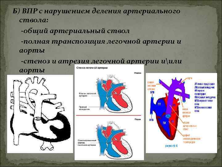 Атрезия легочной артерии тест нмо с ответами. Деление легочной артерии. Общий артериальный ствол. Общий ствол легочных артерий. Магистральный артериальный ствол.