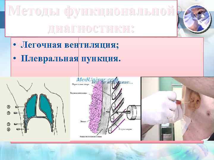 Методы функциональной диагностики: • Легочная вентиляция; • Плевральная пункция. 