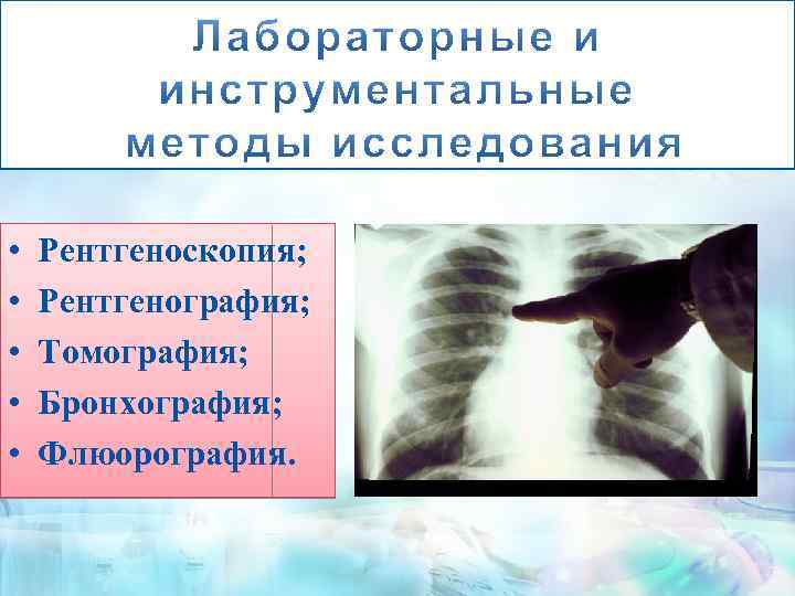  • • • Рентгеноскопия; Рентгенография; Томография; Бронхография; Флюорография. 