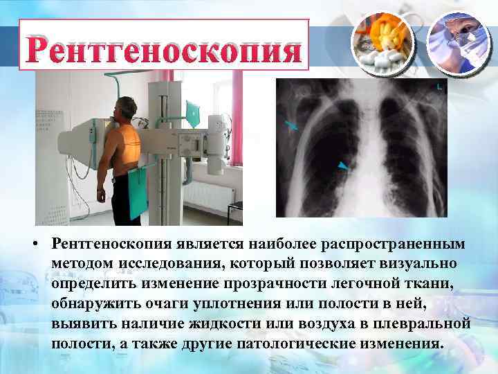 Рентгеноскопия • Рентгеноскопия является наиболее распространенным методом исследования, который позволяет визуально определить изменение прозрачности