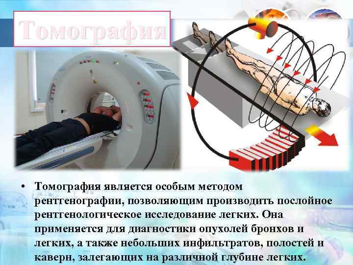 Томография • Томография является особым методом рентгенографии, позволяющим производить послойное рентгенологическое исследование легких. Она