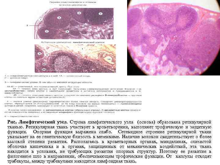 Рис. Лимфатический узел. Строма лимфатического узла (основа) образована ретикулярной тканью. Ретикулярная ткань участвует в
