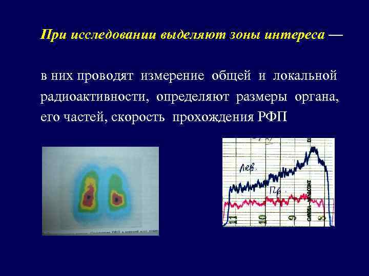 При исследовании выделяют зоны интереса — в них проводят измерение общей и локальной радиоактивности,