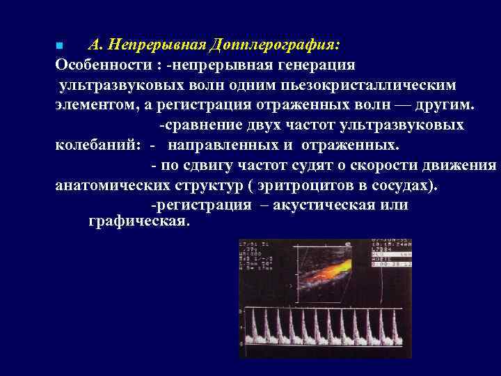 А. Непрерывная Допплерография: Особенности : -непрерывная генерация ультразвуковых волн одним пьезокристаллическим элементом, а регистрация