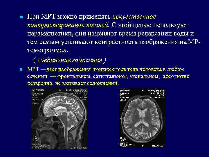 Мрт с контрастом рязань