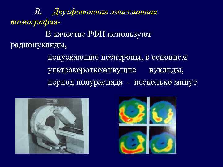 В. Двухфотонная эмиссионная томография. В качестве РФП используют радионуклиды, испускающие позитроны, в основном ультракороткоживущие