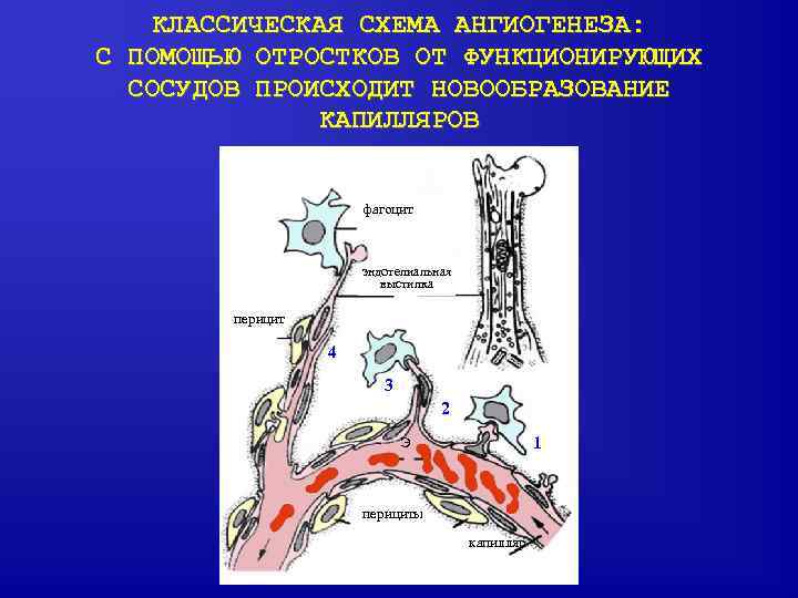 КЛАССИЧЕСКАЯ СХЕМА АНГИОГЕНЕЗА: С ПОМОЩЬЮ ОТРОСТКОВ ОТ ФУНКЦИОНИРУЮЩИХ СОСУДОВ ПРОИСХОДИТ НОВООБРАЗОВАНИЕ КАПИЛЛЯРОВ фагоцит эндотелиальная